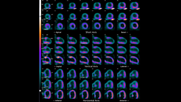 Scintigrafia miocardica a Guidonia-Roma presso lo Studio Radiologico - Prenota l'esame