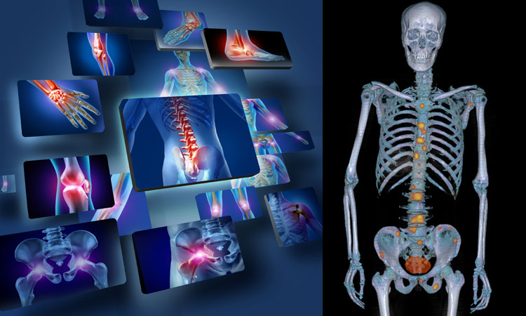 Scintigrafia ossea a Guidonia-Roma presso lo Studio Radiologico - Prenota l'esame